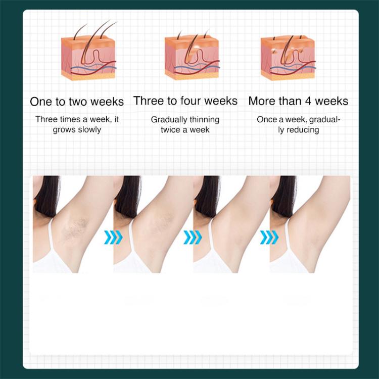 FY-B501 Laser Hair Removal Device Home Electric IPL Intense Pulse Hair Remover, EU Plug, US Plug, UK Plug